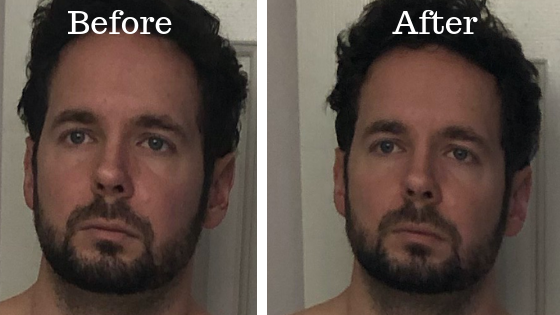 Face before and after 24 hour fast