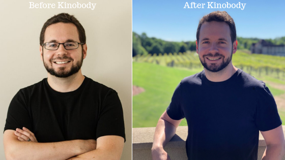 Before and after Kinobody